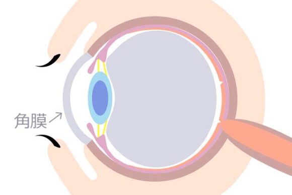 横顔の黒目について【瞳孔は眼球の表面にはない】 | ブログが書けたよ!